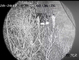 15 Км термического изображения камеры слежения лазера инфракрасн долгосрочного с объективом с переменным фокусным расстоянием